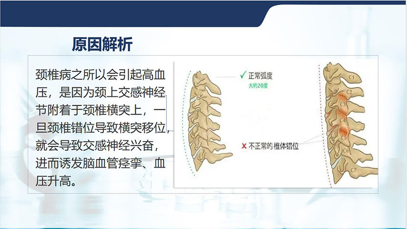 颈椎病也会引起高血压